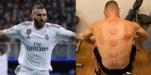 Bintang Real Madrid Karim Benzema Jaga Stamina dengan Terapi ala Rasulullah