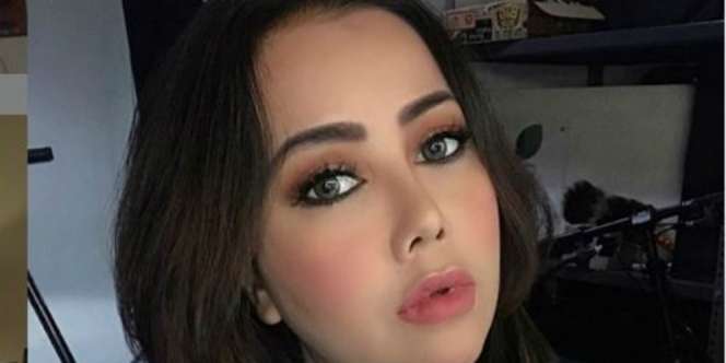 Diduga Alami Malapraktik Klinik Kecantikan, Dagu Kakak Elma Theana Keluar Nanah