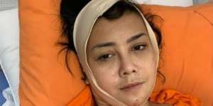 Rency Milano Korban Malapraktik Klinik Kecantikan, Kondisinya Memprihatinkan