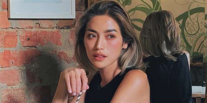 Tak Hanya Takikardia, Dokter Ungkap Penyakit Lain Jessica Iskandar
