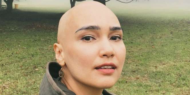 Feby Febiola Shock Saat Divonis Kanker Ovarium