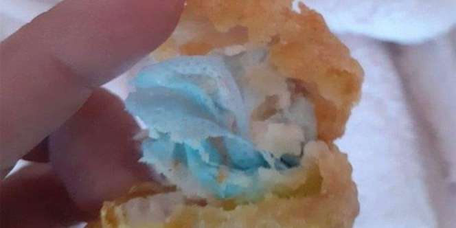 Anak Tersedak Saat Makan, Ibu Temukan Gumpalan Masker di Dalam Nugget