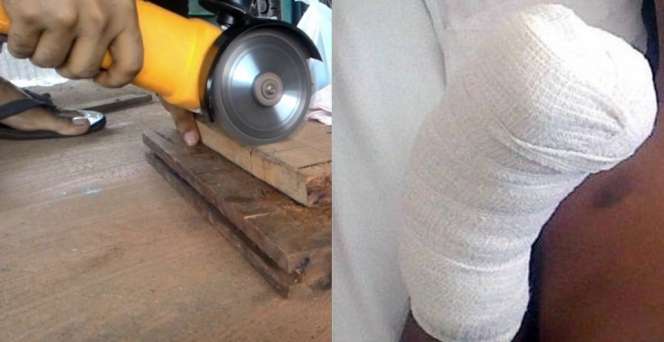 Ini Bahaya Memotong Kayu Pakai Gerinda, Jari dan Kaki Bisa Putus