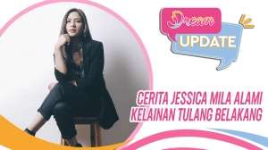 Cerita Jessica Mila Alami Kelainan Tulang Belakang Sejak SMP
