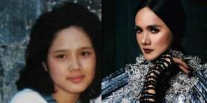 Mengintip 6 Potret Wajah Seleb Sebelum dan Sesudah Terkenal