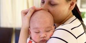 Sang Anak Idap Dermatitis Atopik, Reaksi Mona Ratuliu Curi Perhatian Netizen