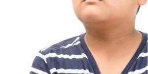 Leher Hitam Bergurat Pada Anak  Bisa Jadi Tanda Diabetes