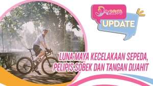 Luna Maya Kecelakaan Sepeda, Pelipis Sobek dan Tangan Dijahit