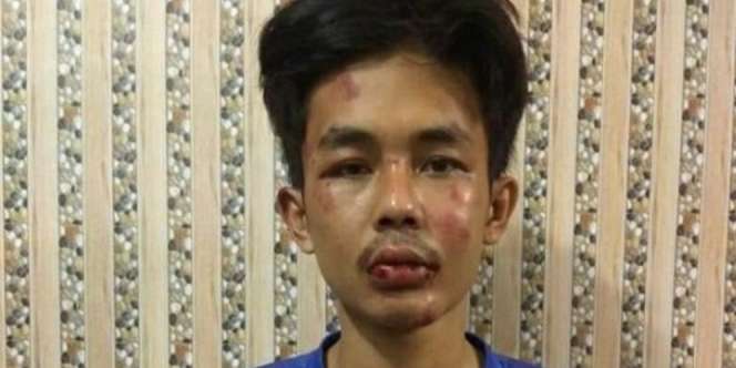 Polisi: Penusuk Syekh Ali Jaber Mengaku Terganggu Pengeras Suara