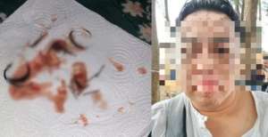 Wajah Tampan Jadi Rusak, Sutradara Jadi Korban Santet