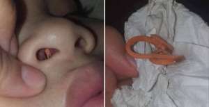 Hidung Anak Bau Busuk, Ibu Kaget Setengah Mati Saat Mengoreknya