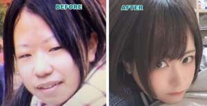 Posting Foto Before After, Transformasi Wajah Cewek Ini Sulit Dipercaya