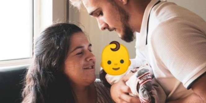 Kisah Pilu Bayi Tanpa Wajah, Tak Miliki Mata dan Hidung