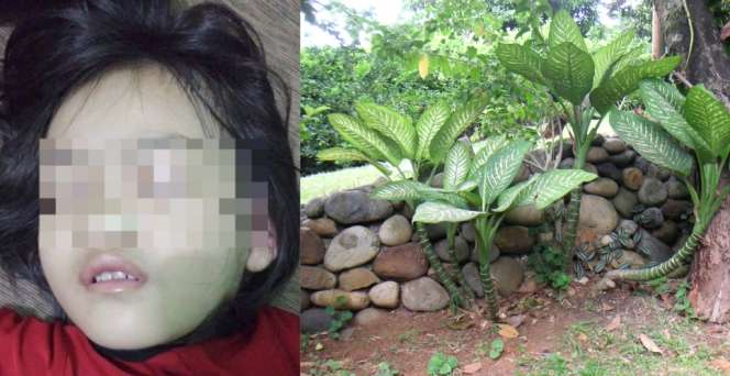 Makan Tanaman Hias Ini, Bocah 4 Tahun Keracunan, Bibir Nganga dan Lidah Kejang