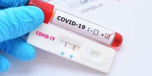 Sempat Muncul di 2002, Ini Penyebab Wabah Covid-19 Saat Ini Lebih Ganas