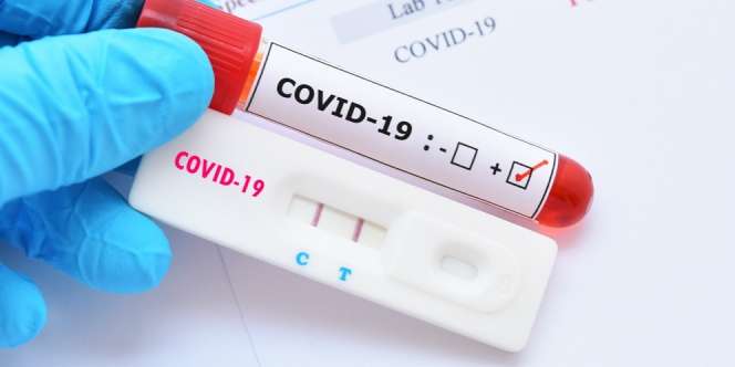 Sempat Muncul di 2002, Ini Penyebab Wabah Covid-19 Saat Ini Lebih Ganas