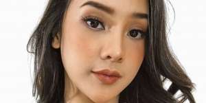 Pakai Rok Mini, Tanda Merah di Paha Anya Geraldine Bikin Salfok