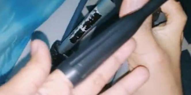 Iseng Masukkan Telunjuk ke Tripod, Jari Pemuda Ini Nyangkut di Seharian