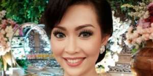 Mau Terlihat Muda, Ratna Listy Operasi Hidung
