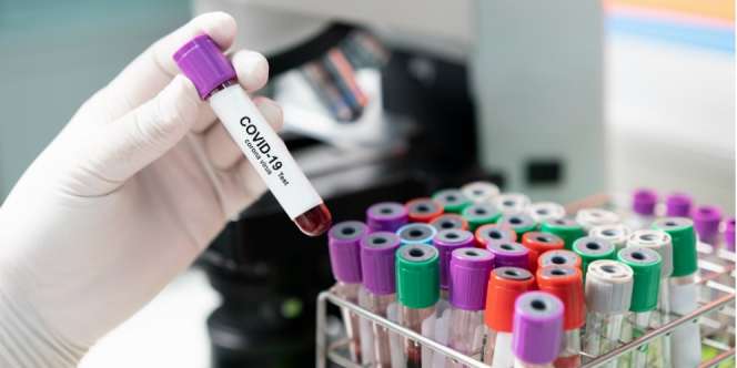 Muncul Mutasi Baru Virus Covid-19 di Inggris, 70 Persen Lebih Menular
