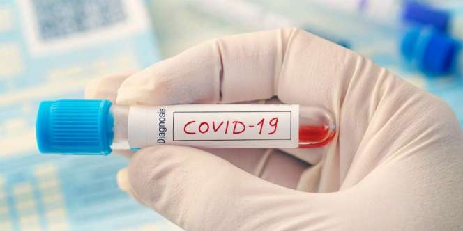 Vaksin Covid-19 Dongkrak Optimisme Pengusaha Tahun Depan