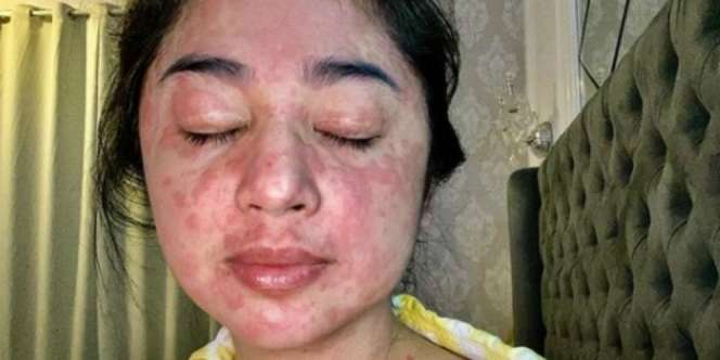 Doa Dewi Perssik Usai Sembuh dari Covid-19: Kalau Tak Sakit Itu Namanya Malaikat