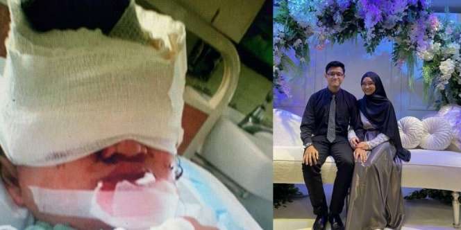 Kekuatan Makeup Ubah Pengantin Wanita dengan Luka Parut Jadi Cantik
