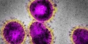 Hati-Hati! Wabah Virus Nipah Serang Malaysia, Ini Pemicu dan Efek Fatalnya