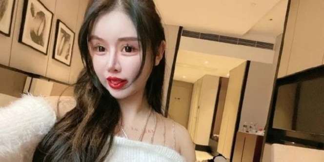 Baru 16 Tahun, Influencer Kecanduan Oplas dan Begini Hasilnya