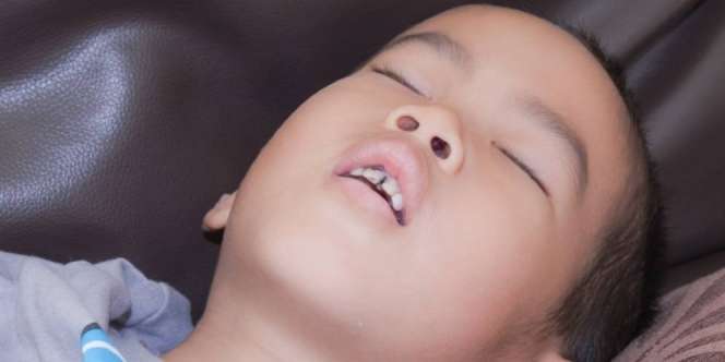 Jangan Anggap Sepele Bila Anak Sering Tidur dengan Mulut Terbuka