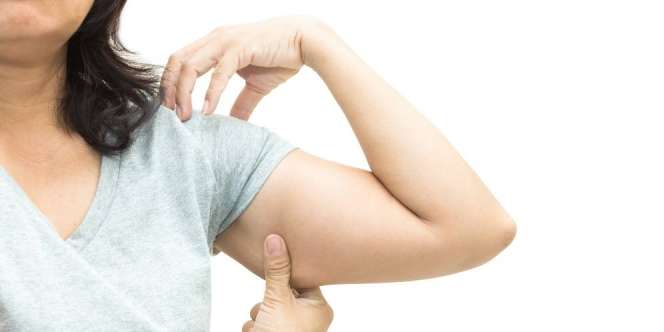 Bukan Cuma Berat Badan Berlebih, Ini Sebab Ketiak Bergelambir
