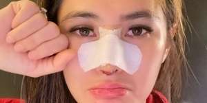 Operasi Plastik, Wajah Angela Lee Jadi Sorotan