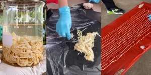 Awalnya Cuma Perut Kembung, Dikasih Obat Malah Keluar Cacing Pita 18 Meter