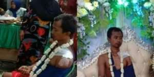 Fakta Pengantin Pria Berbalut Perban di Pernikahan, Bisa Jadi Pelajaran