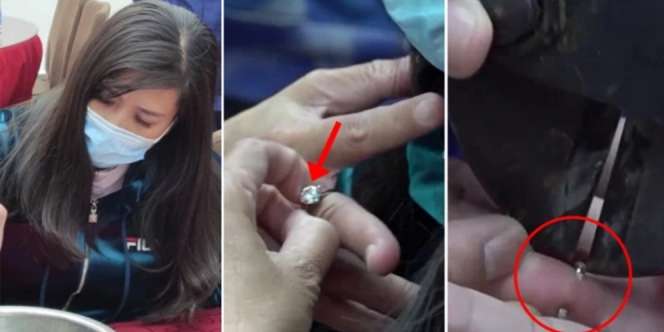 Bobot Naik 10 Kg, Damkar Sampai Turun Tangan Lepas Cincin Berlian Perempuan Ini