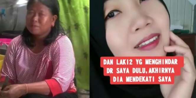 Dulu Dihina karena Hitam Dekil, Sejak Kenal 'Skincar' Banyak yang Mendekat
