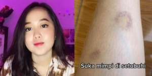 Pengalaman Mistis Disukai Makhluk Halus, Berhubungan Intim Sampai Badan Memar