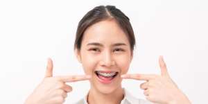 4 Tips Tampil Menarik saat Memakai Behel