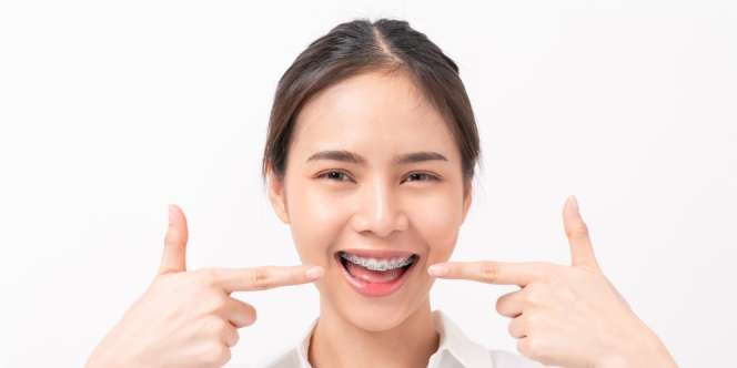 4 Tips Tampil Menarik saat Memakai Behel