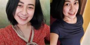 Foto-Foto Cantik Eva Sofiana, Perawat yang Dibakar oleh Pria Misterius