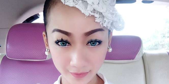 Dulu Kaya Raya, Pedangdut Elyn Munchen Lumpuh sampai Jual Semua Harta