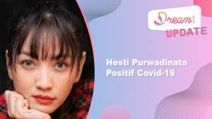 Hesti Purwadinata Positif Covid-19, Begini Kondisinya Sekarang