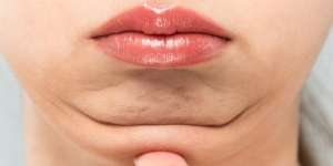 4 Bahan Alami Ini Bisa Mengatasi Double Chin