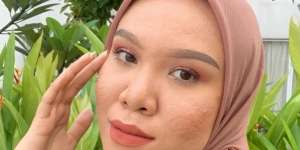 Cerita Selebgram Cut Rizki Berdamai dengan Jerawat