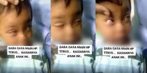 Diduga Keseringan Main HP, Bocah Ini Tak Bisa Membuka Mata dengan Wajar