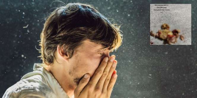 Sembuh dari Covid-19, Penyintas Panik Lihat Benda Asing Keluar dari Hidung