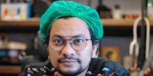 Analogikan Pasang Behel, Ini Jawaban Tompi Ditanya Hukum Operasi Plastik Haram