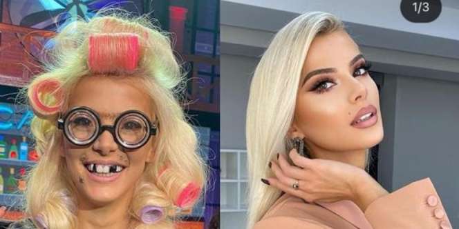 5 Foto Sebelum dan Sesudah Makeup Pengantin yang Bikin Terkejut