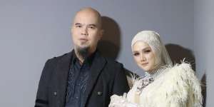 Tak Lagi Mulus, Mulan Jameela Perlihatkan Kondisi Telapak Tangan Mengelupas