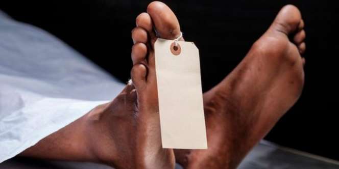 Mahasiswa Kedokteran Syok, Mayat untuk Praktik Bedah Ternyata Teman Sendiri